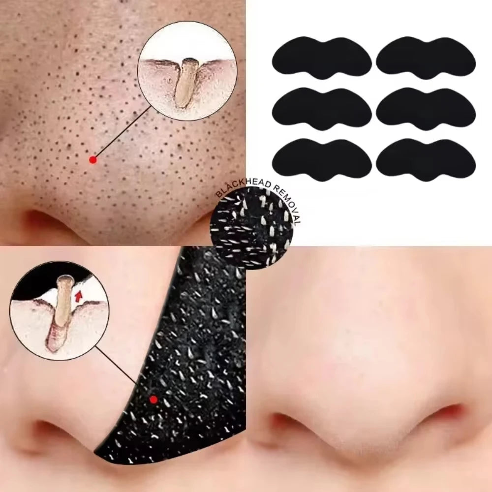 Blackhead Remover Patches - Deep Cleansing Facial Patches to Absorb Blackheads & Clean Pores (10/50/100 Pieces)